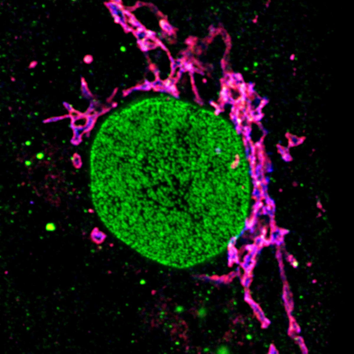 Three color STED and confocal image of a mammalian cultured cell.