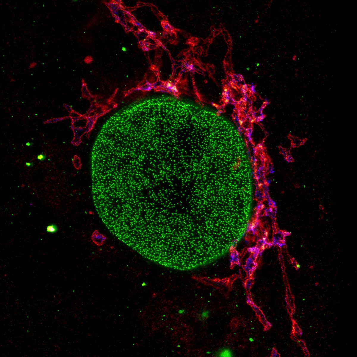 Three color STED and confocal image of a mammalian cultured cell.